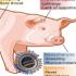 ما هي انفلونزا الخنزير