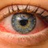 ما هي الأمراض التي تصيب العين